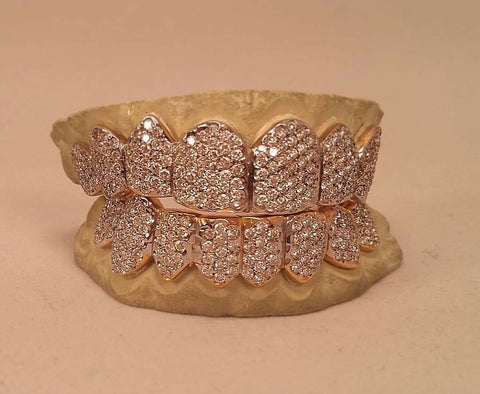 Custom Diamond Grillz